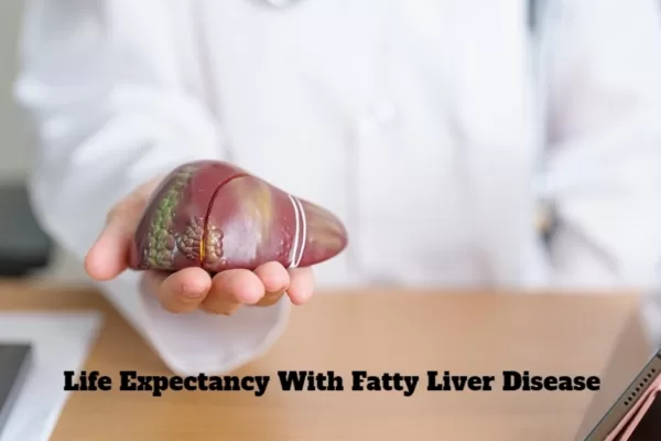life expectancy with fatty liver disease