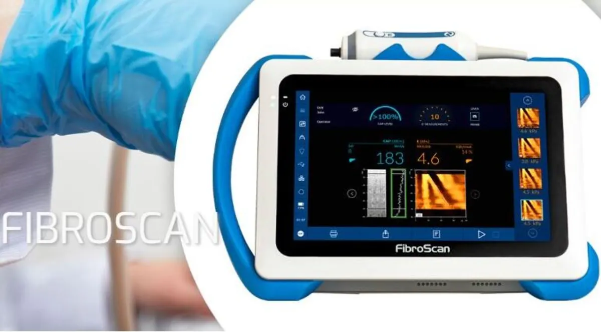 FibroScan